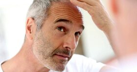 آیا کووید ۱۹ دلیل ریزش مو است؟